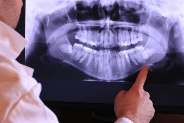 Best Emergency Dentist for Knocked-Out Tooth in Pearsall, TX